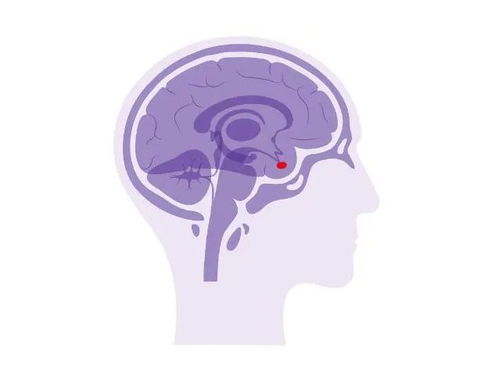 突然变胖变丑视力下降?警惕垂体瘤影响生殖激素