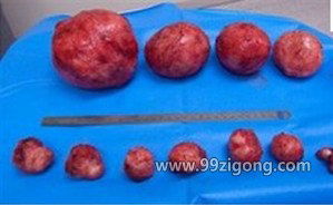 生殖系统与生殖激素