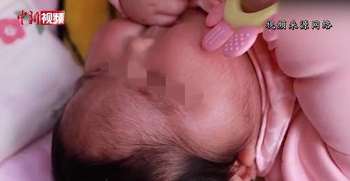 “婴儿霜致大头娃娃”事件进展 产品含生殖激素，涉案人员已被传唤